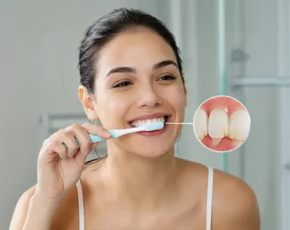 Tired of Plaque on Your Teeth? Here’s What You Need to Do